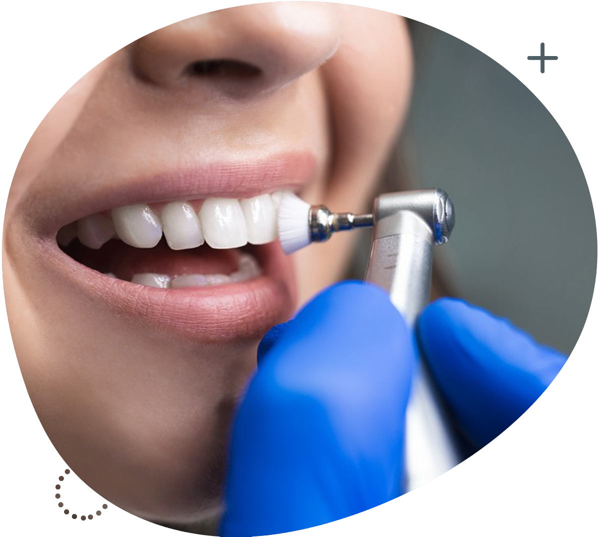 https://www.dental-center.ro/wp-content/uploads/periaj-profesiona-dentar-deva.png